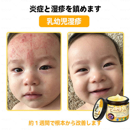✨💜💜APKAPK® 𝗠É𝗛𝗠É𝗥𝗘𝗚 総合クリーム🥇 皮膚の隆起に対するケアには以下が含まれます： 加齢によるシミ、傷跡、いぼ、皮膚の隆起、脂肪の塊、ニキビ、湿疹、乾癬、反転性ニキビ、しわ、皮膚の老化およびその他の問題🔥
