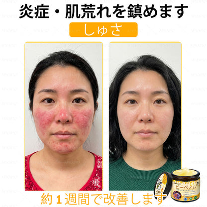 ✨💜💜APKAPK® 𝗠É𝗛𝗠É𝗥𝗘𝗚 総合クリーム🥇 皮膚の隆起に対するケアには以下が含まれます： 加齢によるシミ、傷跡、いぼ、皮膚の隆起、脂肪の塊、ニキビ、湿疹、乾癬、反転性ニキビ、しわ、皮膚の老化およびその他の問題🔥