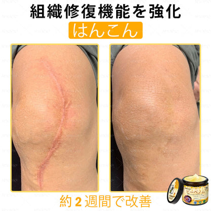 ✨💜💜APKAPK® 𝗠É𝗛𝗠É𝗥𝗘𝗚 総合クリーム🥇 皮膚の隆起に対するケアには以下が含まれます： 加齢によるシミ、傷跡、いぼ、皮膚の隆起、脂肪の塊、ニキビ、湿疹、乾癬、反転性ニキビ、しわ、皮膚の老化およびその他の問題🔥