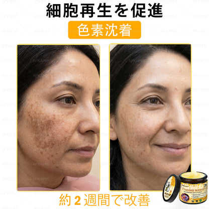 ✨💜💜APKAPK® 𝗠É𝗛𝗠É𝗥𝗘𝗚 総合クリーム🥇 皮膚の隆起に対するケアには以下が含まれます： 加齢によるシミ、傷跡、いぼ、皮膚の隆起、脂肪の塊、ニキビ、湿疹、乾癬、反転性ニキビ、しわ、皮膚の老化およびその他の問題🔥